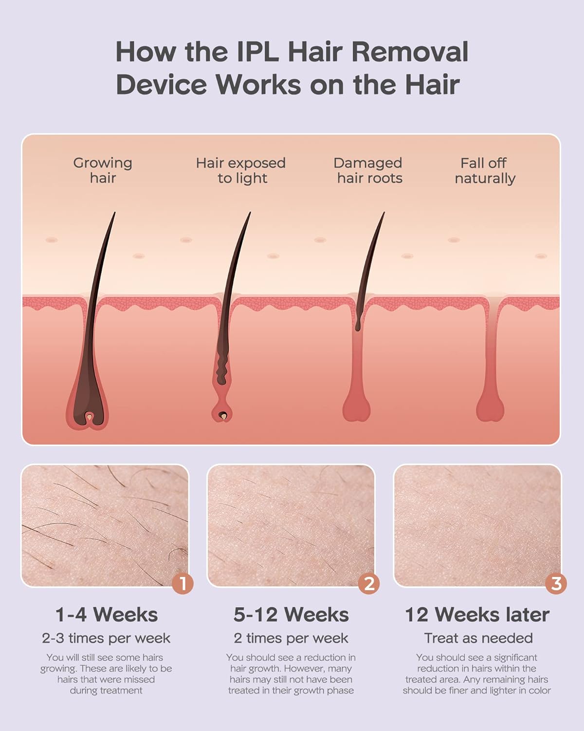 999,000 Flashes IPL Hair Removal Device Y8548